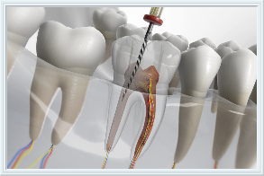 Associação Goiana de Odontologia, gestão de clínicas odontológicas, Parceiros Associados Cooperação que garante, atendimento de qualidade. Associação Goiana de Odontologia, Clínica Odontológica, clinica odontologica confiavel, consultorio odontologia referencia, melhor dentista de goiania, melhor dentista de goias, Atendimento especializado, Tratamento de Canal, Facetas Aparelhos dentários Implantes Próteses Clareamento Preço justo Económico Referencia dor de dente especialista, Associação Goiâna de Odontologia, Clinica odontologica, clinica odontologica goias, clinica odontologica goiania, clinica odontologica Porangatu, clinica odontologica Morrinhos, clinica odontologica Cristalina, clinica odontologica Mineiros, clinica odontologica Santo Antônio do Descoberto,  clinica odontologica Goianésia, clinica odontologica Cidade Ocidental, clinica odontologica Caldas Novas,  clinica odontologica Jataí, clinica odontologica novo gama, clinica odontologica Planaltina, clinica odontologica Itumbiara, Clinica odontologica Catalão, clinica odontologica Formosa, clinica odontologica Trindade, clinica odontologica Senador Canedo, clinica odontologica Valparaíso de Goiás, clinica odontologica Luziânia, clinica odontologica Águas Lindas de Goiás, clinica odontologica Rio Verde, clinica odontologica Anápolis, clinica odontologica clinica odontologica Aparecida de Goiânia, Emergência odontológica, Dentista, Dentista goias, Dentista goiania, Dentista Porangatu, Dentista Morrinhos, Dentista Cristalina, Dentista Mineiros, Dentista Santo Antônio do Descoberto,  Dentista Goianésia, Dentista Cidade Ocidental, Dentista Caldas Novas,  Dentista Jataí, Dentista novo gama, Dentista Planaltina, Dentista Itumbiara, Dentista Catalão, Dentista Formosa, Dentista Trindade, Dentista Senador Canedo, Dentista Valparaíso de Goiás, Dentista Luziânia, Dentista Águas Lindas de Goiás, Dentista Rio Verde, Dentista Anápolis, Dentista clinica odontologica Aparecida de Goiânia, Emergência odontológica, implantes dentários, melhor dentista de goiânia, lentes de contato dental, facetas de resina, faceta de porcelana, dente quebrado, dente doendo, tratamento de caries, clareamento, proteses, proteses sobre implante, proteses protocolo, aparelho ortodôntico, harmonização facial, limpeza dental, odonto pediatria, periondotia, ago associacao goiana de odontologia ,Atendimento odontológico de urgência, Ação de emergência, Socorro, Dor de dente, Bolha na gengiva, consultorio odontologico, remedio para dor de dente, emergência odontologica, assessoria contábil especializada para consultórios odontológicos, assessoria contábil especializada para dentistas, assessoria contábil especializada para clinicas odontológicas, assessoria jurídica especializada para dentistas, assessoria jurídica especializada para clinicas odontologicas, assessoria jurídica especializada para consultorios odontologicos, assessoria jurídica especializada para dentistas, assessoria comercial especializada para consultorios odontologicos, assessoria comercial especializada para dentistas, assessoria comercial especializada para clinicas odontologicas, tartaros, mau hálito, dentes sensíveis, bolha na gengiva, gengiva sangrando